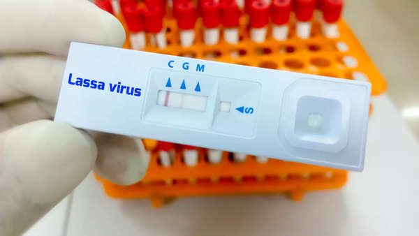 virus de Lassa