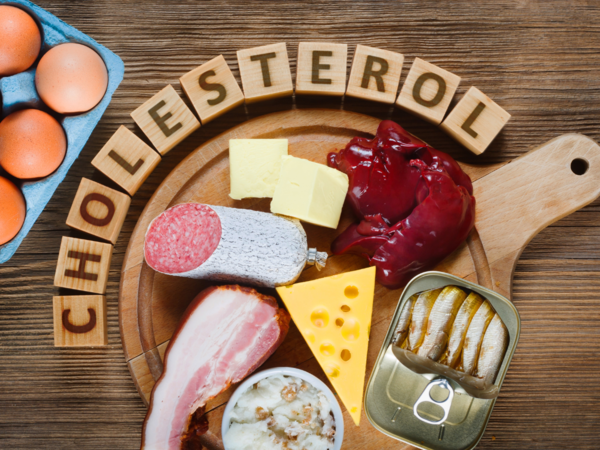 Cholesterol