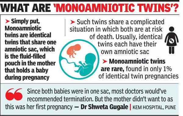In rare surgery, doctors deploy laser to remove ‘parasitic twin’