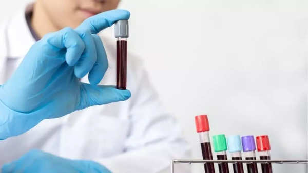 Dementia blood test (1)