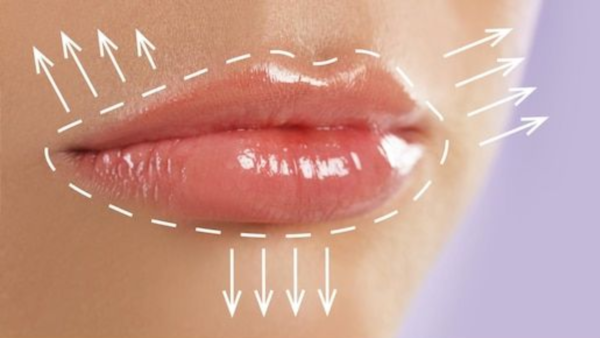 Lip enhancement techniques