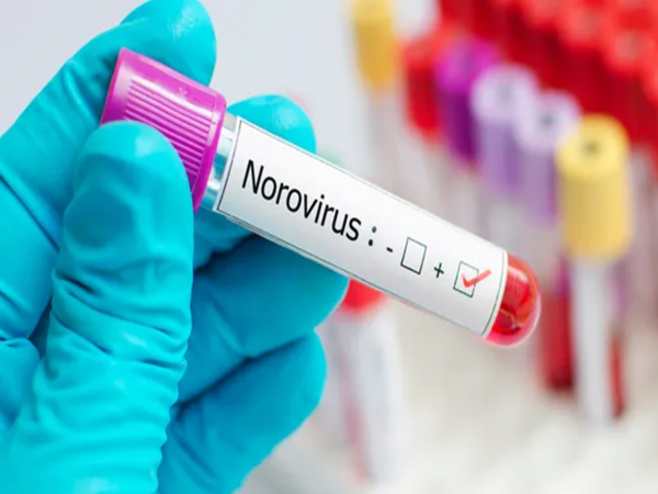 Norovirus cases surge in the US