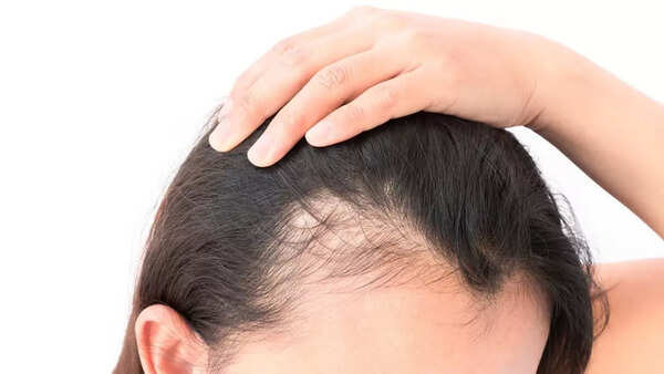 Hair diet (1)