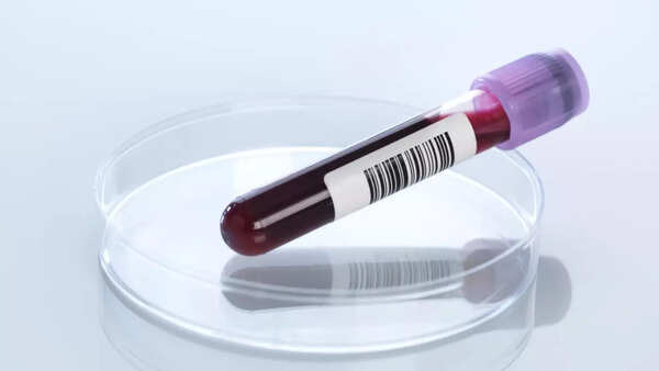 Blood test (2)