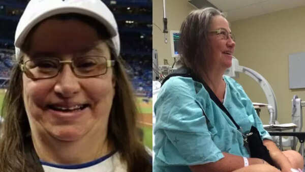 Heart Transplant (4)