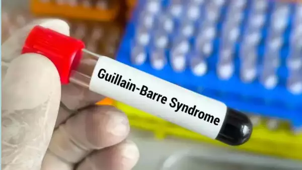 Guillain-Barré Syndrome (GBS).