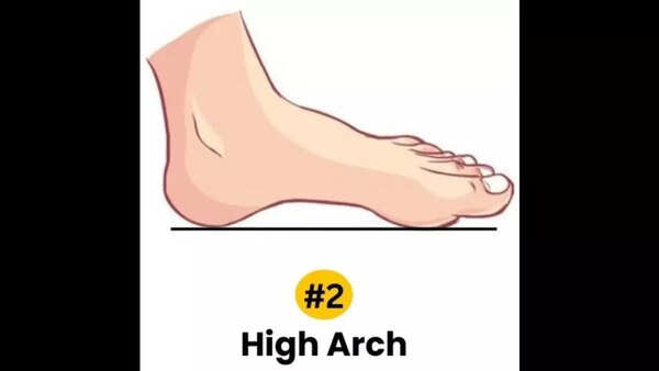 High arch foot personality traits