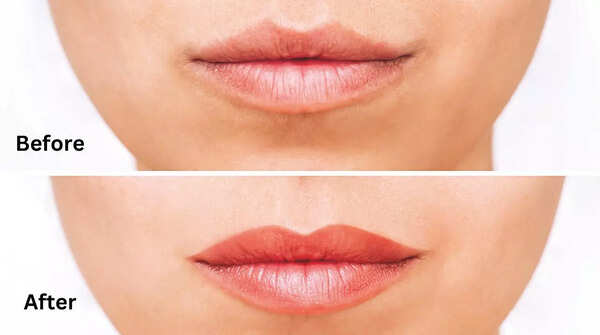 Before After image of lip tattoo treatment