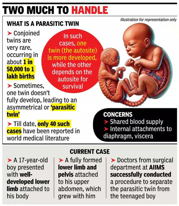 Docs separate ‘parasitic twin’ from 17-yr-old