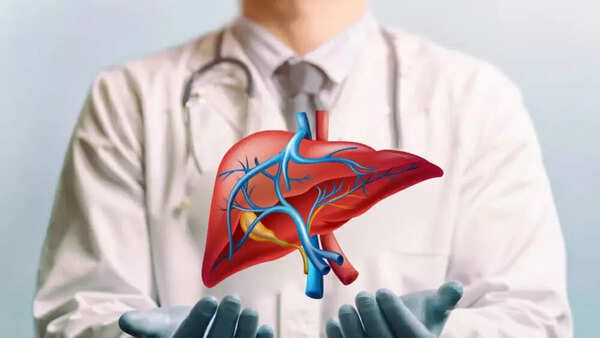 Liver transplant
