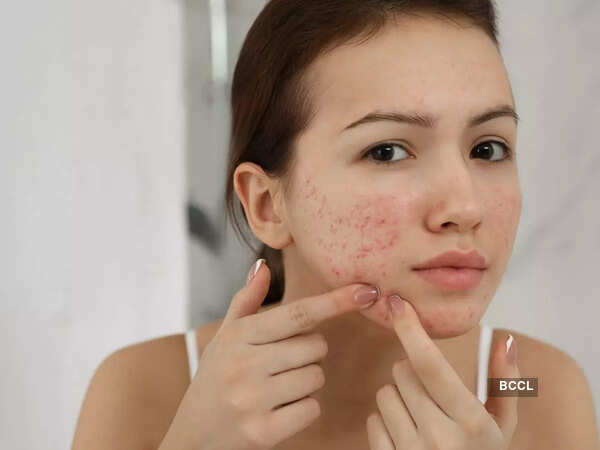 Skin irritation