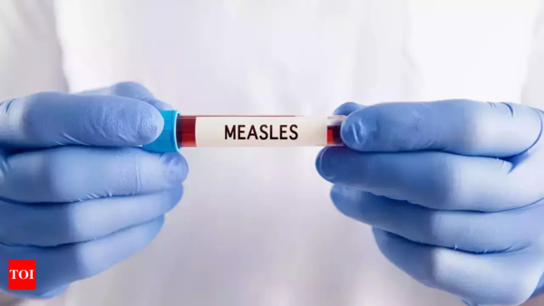 Texas measles