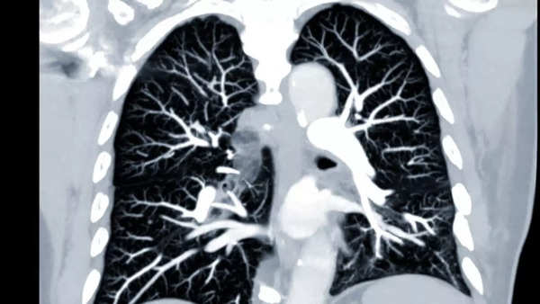 lung imaging 2