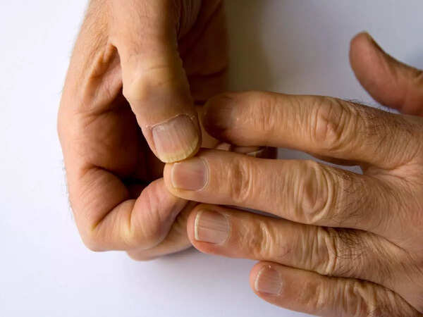 Pale nails