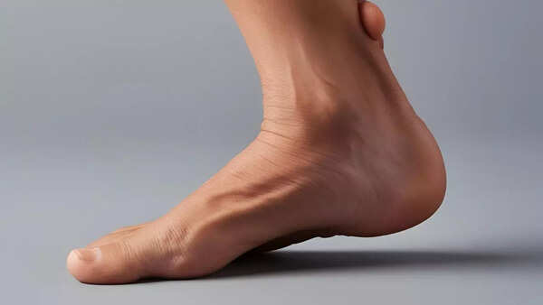 Malleolus