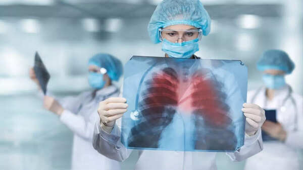 lung imaging