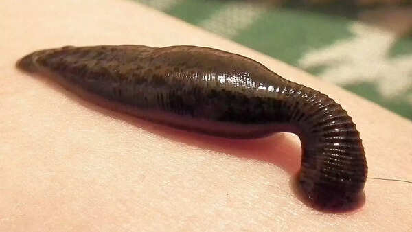 Leeches