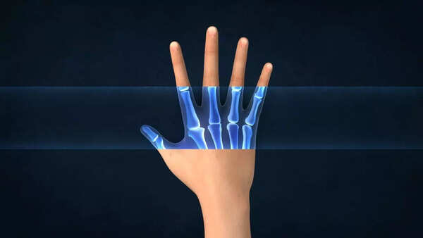 finger test