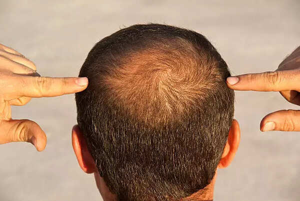 istockphoto-183317971-612x612