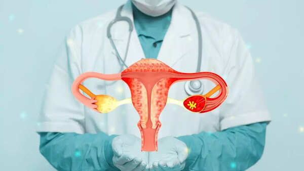ovarian cancer 2