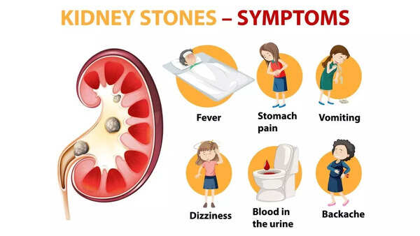kidney stone symptoms