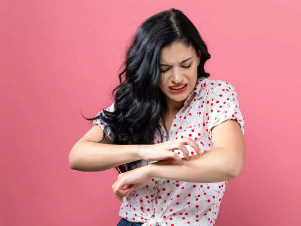 Skin rashes