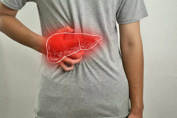 fatty liver