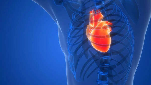heart attack