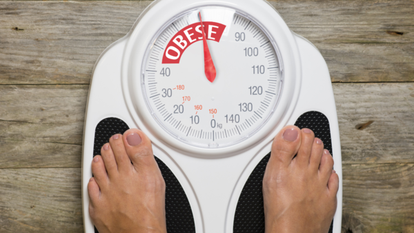 Obesity