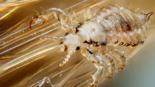 Source: Wikipedia Head lice