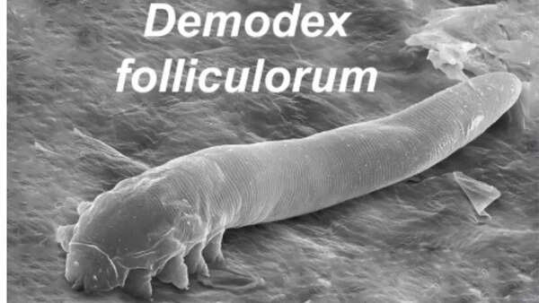 Source: Wikipedia Demodex mites