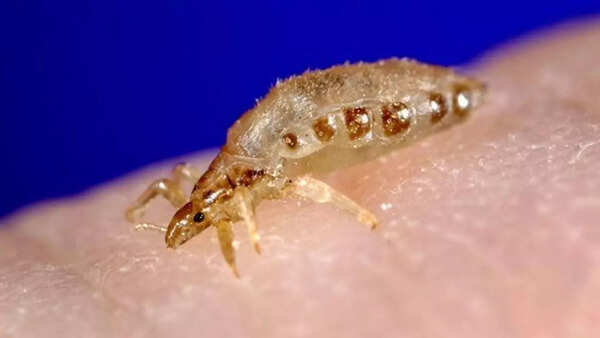 Source: Everyday health Body lice