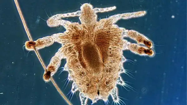 Source: Wikipedia Crab lice