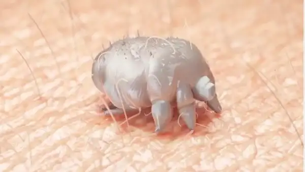 Source: News medical Scabies mites