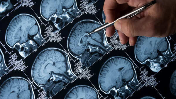 brain