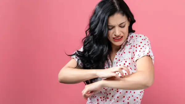 Dry and itchy skin