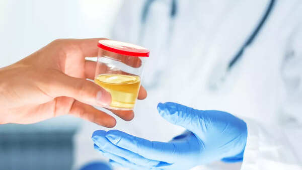 urine