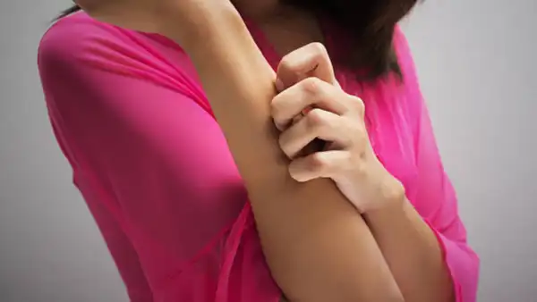 Itchy, red skin rashes