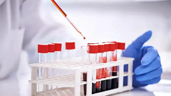 bloodtest