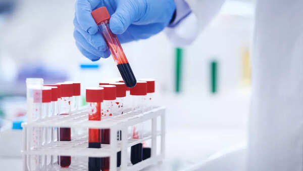bloodtest