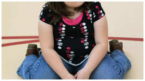 Childhood Obesity Causes
