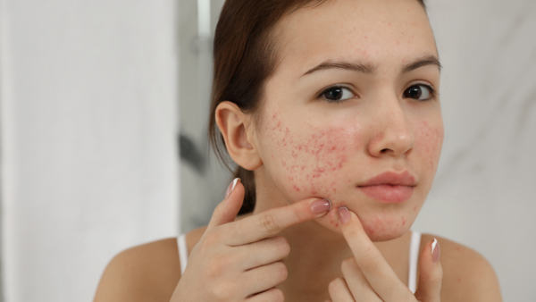 Skin problems