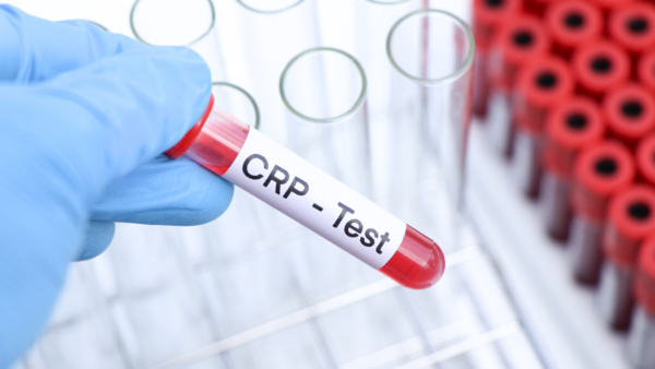 crp test