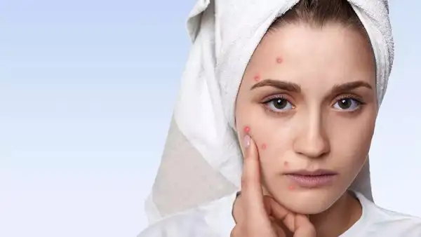 Understanding your skin is the first step to effective care