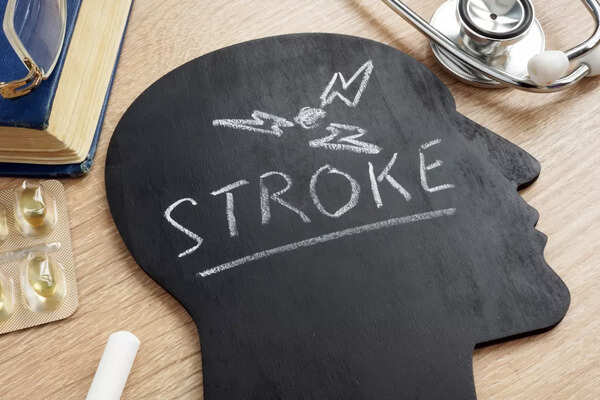 After a mini-stroke, expect progressive cognitive decline, says study