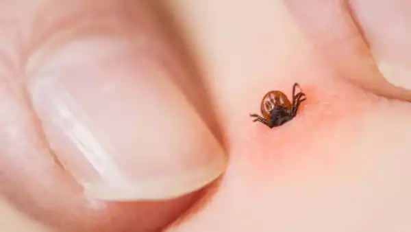 Image credits: Getty Images Health risks posed by tick bites