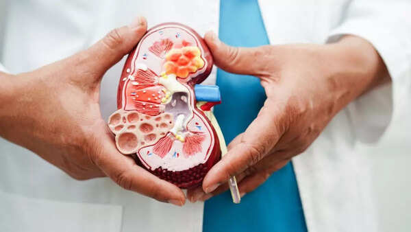 Kidney cancer (1)