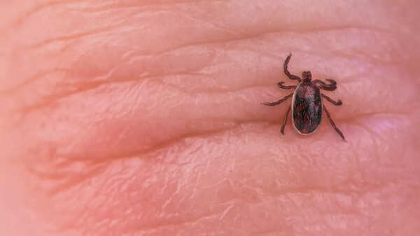 (Pic courtesy: iStock) tick2