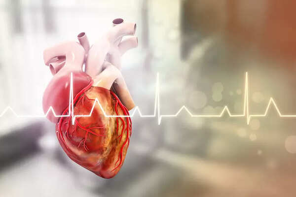 cardiac arrest