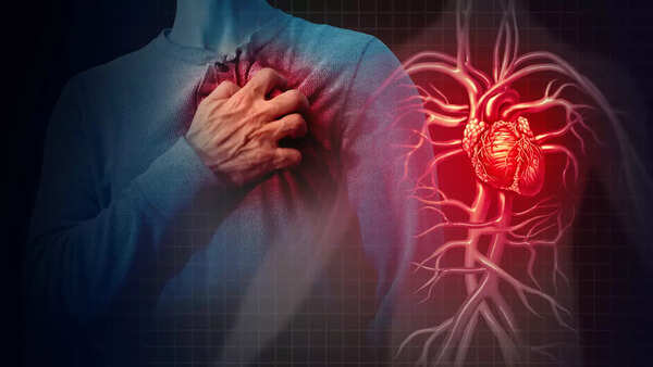 heart attack